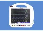 Vitalmax - Model 4100 - Medical Patient Monitors