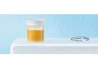 Urinary Tract Infections (UTIs) Services