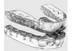 Model dreamTAP - Precision-Fit customTAP Oral Appliance