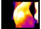 Thermographic Equipment for Medical and Veterinary Applications