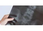 X ray films scrap available