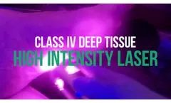 Berman Medical Lasers Trial Offer - Video