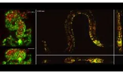 SCAPE 2.0 dual-color 3D imaging of zebrafish embryo and C. elegans.- Video