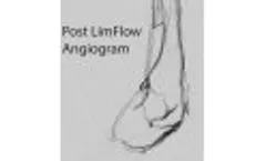 Acute Case Example - Video
