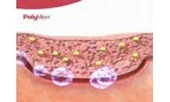 How PolyMem wound dressings work - Video