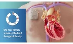 An Overview of CCM Therapy for Medical Professionals - Video