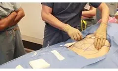 Painless Tumecent infiltration by Jeffrey A. Klein MD - Video