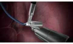Lightpoint Medical robotic probe SENSEI - Video