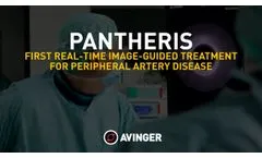 Pantheris the Only Image-Guided Treatment for Peripheral Artery Disease, physicians` testimonial - Video