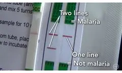 A Cheaper, Easier Way To Test For Malaria - Video