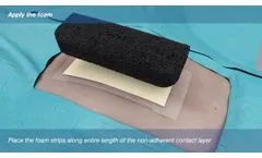 Application Animation Medela NPWT Dressing CSI Foam - Video