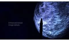 Metaltronica New Helianthus series - digital mammography system- Video