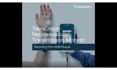 TetraSens Positioning on ADM Muscle- Video