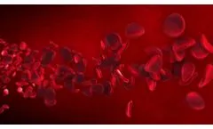 Understanding Stroke - Video