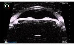 Eye Tracking - Video