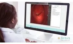 DYSIS Medical Colposcopy Skills - Video