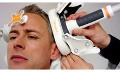 Nexstim navigated TMS is helping make brain surgery safer - Video