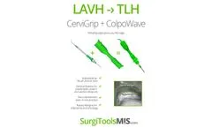 SurgiAssist - Model SGT7101 - Uterine Positioner  Brochure