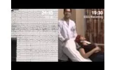 microEEG vs. Standard EEG System - Video