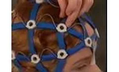Epilepsy EEG with HydroDot System: Video 2 - Long Hair - Video