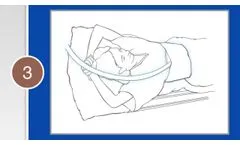 MR Elastography - Patient Setup - Video