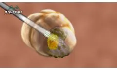NeuroBlate System, manufactured and submitted by Monteris Medical Corporation USA - Video