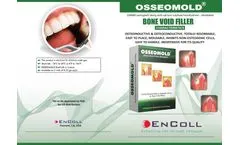 Encoll OsseoMold - Bone Void Filler - Brochure