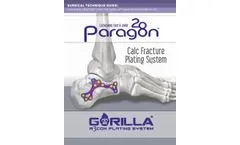 Calc Fracture Plating System Surgical - Technique Guide