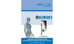 Humerus Interlocking Nail System - Brochure
