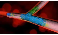Dedicated Bifurcating Stent by Advanced Bifurcation Systems - Video
