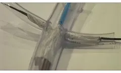 Aortorenal Stent Graft Prototype - Video