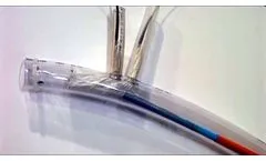 Double-Branch Nonmodular Aortic Stent Graft Deployment Model - Video