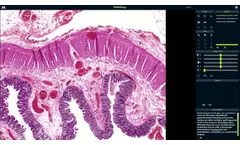 Asclepius- Virtual Dissection Table - Video
