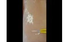 Kogent Surgical Focused Forceps vs "Yellow" Forceps - Video