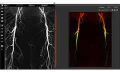 Kinepict Academy: How to generate DVA image types? - Video