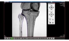 Surgeon`s Checklist TRAUMA  - Video