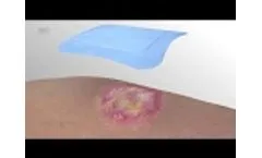 Vliwasorb Pro (EN) - Video