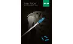 Inion FixOn - Biocomposite Suture Anchor - Brochure
