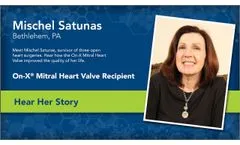 3 Time Open Heart Surgery Patient Mischel Satunas Tells Her Story - Video