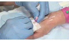 Cannula - Video