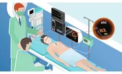 MDoloris Medical Systems presents ANI (Analgesia Nociception Index) technology - Video