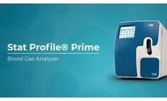StatProfile Prime Blood Gas Analyzer from Nova Biomedical | TECOM Analytical Systems - Video