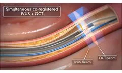 Novasight Hybrid System | Conavi Medical - Video