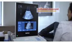 FibroScan?? Expert 630 video clip English version - Video