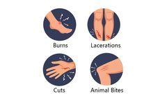 Wound Care Nurse Teaching:DOs and DON'Ts for Wounds Healing