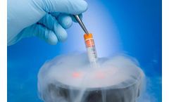 What is Cryogenic Storage?