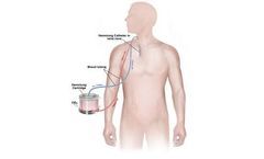 Hemolung - Fully Integrated Respiratory Dialysis System (RAS) for Patients and Caregivers