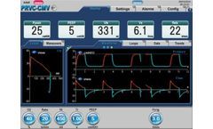 Ventilators for Heliox Ventilation