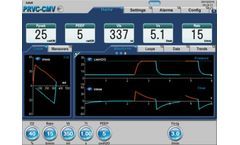 Ventilators for PRVC