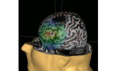 Transcranial Magnetic Stimulation (TMS) for Neurosurgery